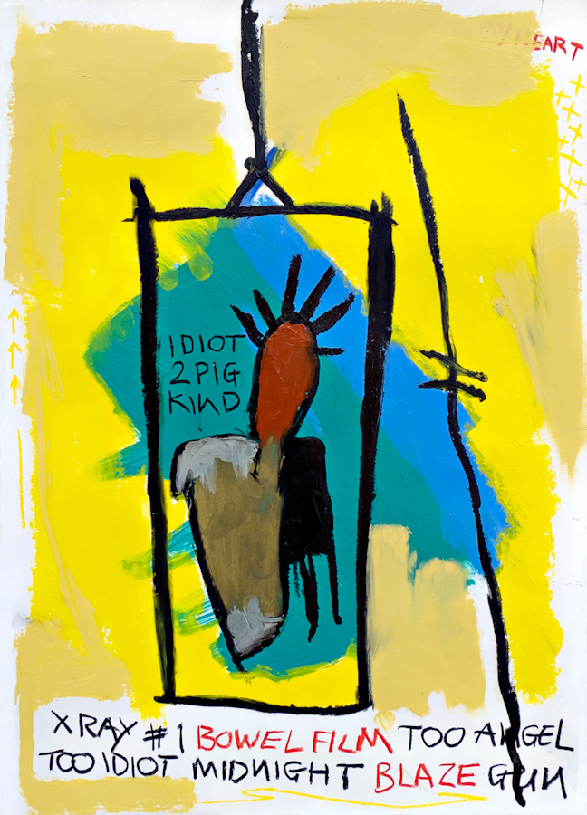 X-Ray